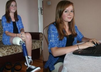 Pomóżmy Joli spełnić marzenia