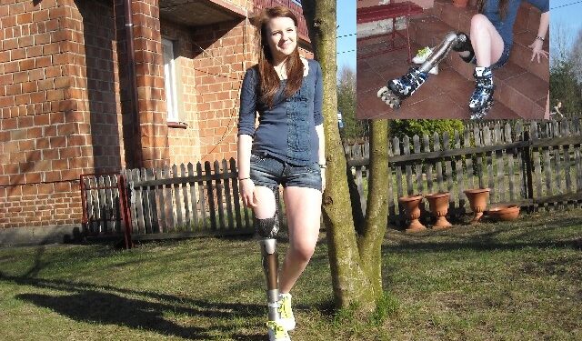 Ulanów: Jola w wymarzonej protezie stanęła na rolkach.