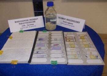 Tarnobrzeg. Dni otwarte Tarnobrzeskiego Oddziału Wojewódzkiej Stacji Sanitarno Epidemiologicznej.
