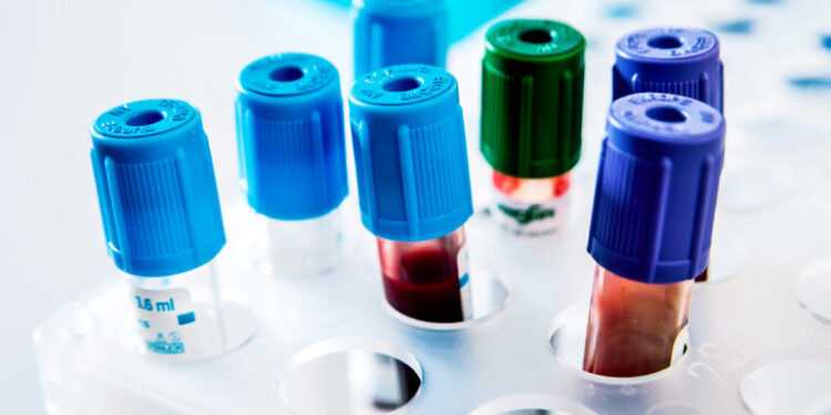 Mielec: Laboratorium na L4.