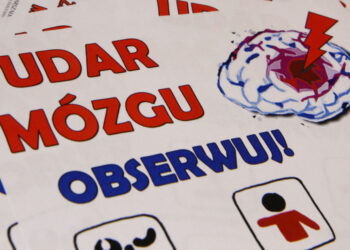 Udar mózgu – co warto wiedzieć?