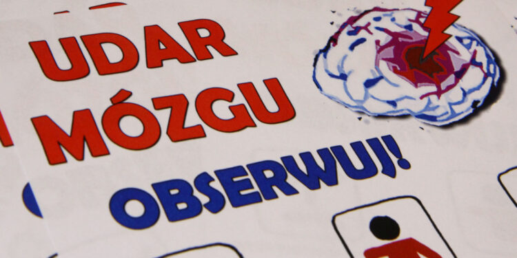 Udar mózgu – co warto wiedzieć?