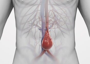 Mielec:  Szpital prowadzi profilaktykę tętniaka aorty brzusznej