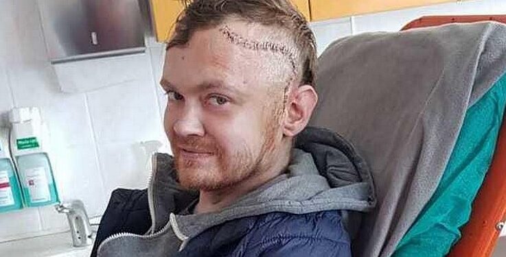 Mielec: Wspomóżmy Kubę w walce z glejakiem.