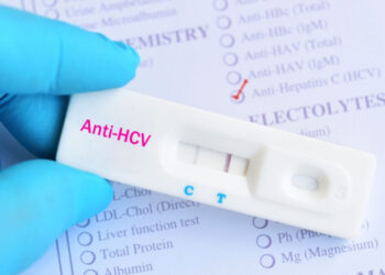 Tarnobrzeg. Bezpłatne badania. Test anty – HCV.