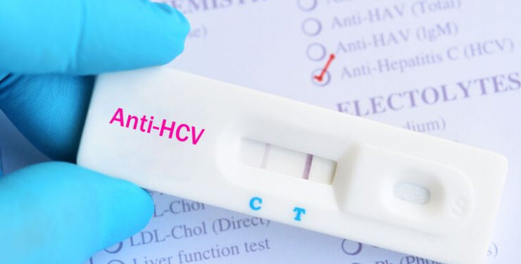 Tarnobrzeg. Bezpłatne badania. Test anty – HCV.