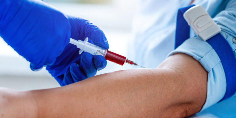 Region: Krew ciągle potrzebna.