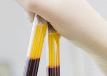 Stalowa Wola: Apel o oddawanie osocza przez ozdrowieńców