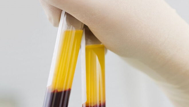 Stalowa Wola: Apel o oddawanie osocza przez ozdrowieńców