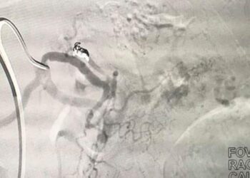 Sandomierz: Nowoczesna metoda leczenia guzów nowotworowych już stosowana w sandomierskim szpitalu.