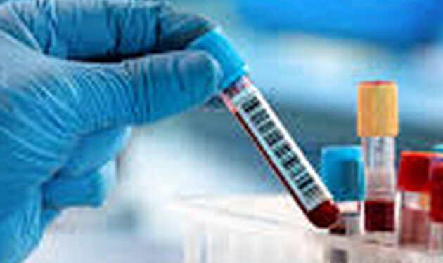 Stalowa Wola: Zwiększą się możliwości szpitalnego laboratorium