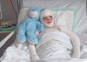 Turbia: Pomóżmy poparzonemu 14-letniemu Radkowi