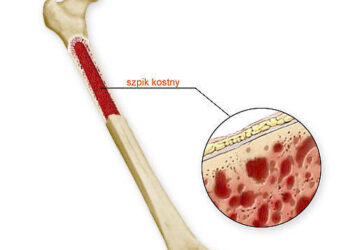 Tarnobrzeg. Młoda mama czeka na przeszczep szpiku kostnego.
