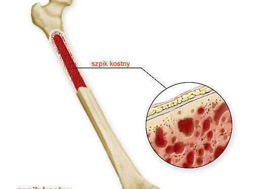 Tarnobrzeg. Młoda mama czeka na przeszczep szpiku kostnego.