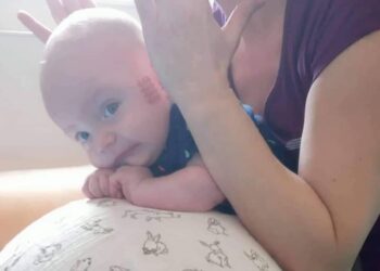 Sandomierz: Bartuś walczy – potrzeba jeszcze ponad 8 milionów. Radosław Majdan włącza się w pomoc.