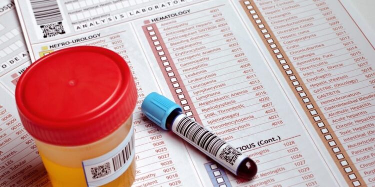 Mielec: Wyniki badań – przez stronę internetową szpitala.