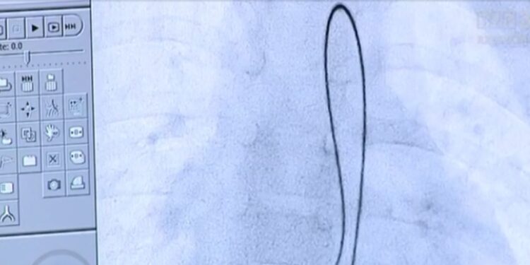 Region:  Zabiegi operacyjne z robotem w tle…