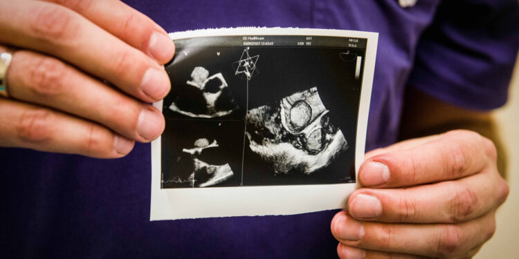 Stalowa Wola: W stalowowolskim szpitalu wykonywane są badania echokardiografi w wersji 3D