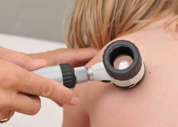 Mielec: Bezpłatne badanie znamion u dzieci