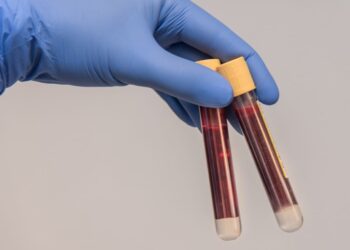 Mielec: Potrzebna krew