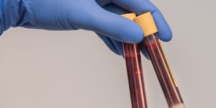 Mielec: Potrzebna krew