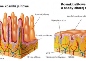Sandomierz: 16 maja Międzynarodowy Dzień Celiakii